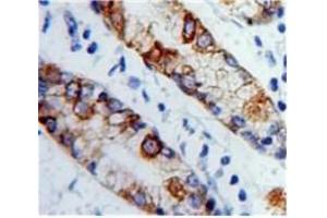 Immunohistochemistry (IHC) image for anti-Collagen, Type XVII (COL17) (AA 184-375) antibody (ABIN7434701)