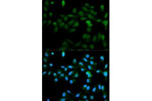 Immunofluorescence analysis of MCF-7 cells using CYP11A1 antibody (ABIN5970856). (CYP11A1 抗体)