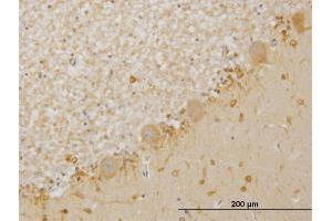 Immunoperoxidase of monoclonal antibody to LIMK1 on formalin-fixed paraffin-embedded human cerebellum. (LIM Domain Kinase 1 抗体  (AA 548-647))