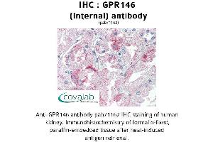 Image no. 3 for anti-G Protein-Coupled Receptor 146 (GPR146) (Internal Region) antibody (ABIN1734950) (GPR146 抗体  (Internal Region))