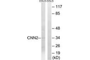 Western blot analysis of extracts from COLO cells, using CNN2 Antibody. (CNN2 抗体  (AA 121-170))