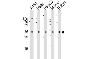 Western blot analysis of lysates from A431, Hela, HepG2 cell line , mouse liver and rat liver tissue lysate(from left to right), using CYB5R3 Antibody (Center) (ABIN6242253 and ABIN6577413). (CYB5R3 抗体  (AA 111-144))