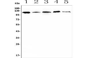 Western blot analysis of HIF1A using anti-HIF1A antibody (ABIN7600453).