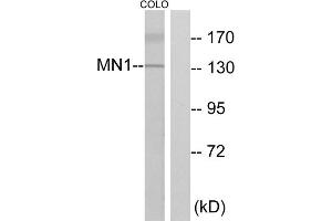 Western blot analysis of extracts from COLO cells, using MN1 antibody. (Meningioma 1 抗体  (Internal Region))