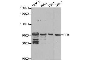 Western Blotting (WB) image for anti-Complement Factor B (CFB) (AA 80-420) antibody (ABIN3015550)