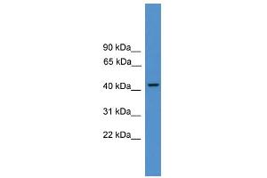 Western Blotting (WB) image for anti-Proteasome (Prosome, Macropain) 26S Subunit, ATPase, 3 (PSMC3) (N-Term) antibody (ABIN2787581)