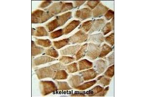 SYNCI Antibody (N-term) (ABIN654757 and ABIN2844441) immunohistochemistry analysis in formalin fixed and paraffin embedded human skeletal muscle followed by peroxidase conjugation of the secondary antibody and DAB staining. (Syncoilin 抗体  (N-Term))