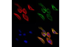 ABIN6261947 and ABIN6276873 staining Hela cells by IF/ICC. (GGT1 抗体  (N-Term))