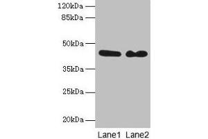 Western blot All lanes: NCK2 antibody at 8 μg/mL Lane 1: Mouse brain tissue Lane 2: Mouse kidney tissue Secondary Goat polyclonal to rabbit IgG at 1/10000 dilution Predicted band size: 43 kDa Observed band size: 43 kDa (NCK2 抗体  (AA 1-380))