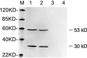Western blot analysis of cell lysates using 1 µg/mL Rabbit Anti-Vimentin Polyclonal Antibody (ABIN398721) Lane 1, 3: Hela cell lysateLane 2, 4: HEK293 cell lysate Primary antibody: Lane 1, 2: Rabbit Anti-Vimentin Polyclonal AntibodyLane 3, 4: Rabbit Anti-Vimentin Polyclonal Antibody pre-incubated with immunizing peptideThe signal was developed with IRDyeTM 800 Conjugated Goat Anti-Rabbit IgG. (Vimentin 抗体  (AA 400-500))