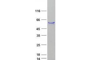 Western Blotting (WB) image for Forkhead Box A1 (FOXA1) protein (Myc-DYKDDDDK Tag) (ABIN2721339)