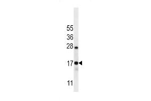 C Antibody (C-term) (ABIN656606 and ABIN2845863) western blot analysis in Ramos cell line lysates (35 μg/lane). (C15orf40 抗体  (C-Term))