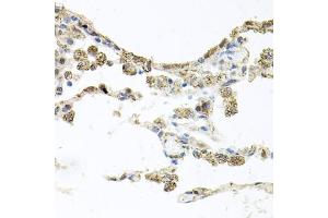 Immunohistochemistry of paraffin-embedded human lung using PIK3CB antibody (ABIN5970370) at dilution of 1/100 (40x lens). (PIK3CB 抗体)
