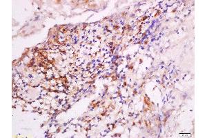 Immunohistochemistry (Paraffin-embedded Sections) (IHC (p)) image for anti-Deoxyribonuclease II, Lysosomal (DNASE2) (AA 25-90) antibody (ABIN872658)