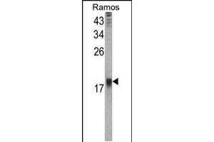 Western blot analysis of UBE2B Antibody in Ramos cell line lysates (35ug/lane) (UBE2B 抗体  (C-Term))
