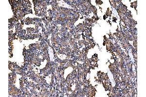 IHC analysis of IRBIT/AHCYL1 using anti-IRBIT/AHCYL1 antibody (ABIN7600030). (AHCYL1 抗体  (AA 14-57))