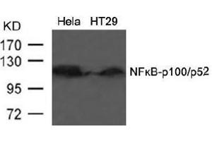 Image no. 3 for anti-Nuclear Factor of kappa Light Polypeptide Gene Enhancer in B-Cells 2 (NFKB2) (AA 864-868) antibody (ABIN197118) (NFKB2 抗体  (AA 864-868))