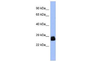 WB Suggested Anti-PDX1  Antibody Titration: 0. (PDX1 抗体  (N-Term))
