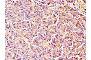 Immunohistochemistry of paraffin-embedded human pancreatic tissue using ABIN7158464 at dilution of 1:100 (REG1A 抗体  (AA 23-166))
