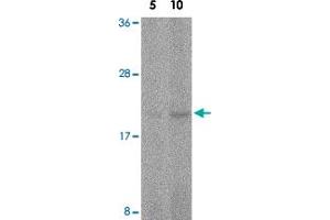 Western blot analysis of FAIM in human spleen tissue lysate with FAIM polyclonal antibody  at 5 and 10 ug/mL . (FAIM 抗体  (C-Term))