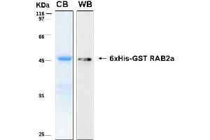 10% SDS-PAGE stained with Coomassie Blue (CB), immunobloting with anti-6xHis (WB) serum and peptide fingerprinting by MALDI-TOF-TOF mass spectrometry (RAB2A Protein (AA 1-212) (His-GST))