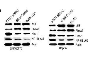 Effect of STAT1 on p53, Fbxw7, Hes-1 and NF-κB p65. (FBXW7 抗体  (AA 501-600))