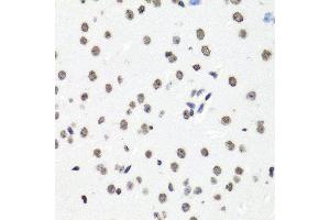 Immunohistochemistry of paraffin-embedded mouse brain using HIST1H2BG antibody (ABIN6003628) at dilution of 1/100 (40x lens). (HIST1H2BG 抗体)