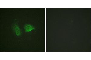 P-peptide - +Western blot analysis of extracts from LOVO cells, using Calcium Sensing Receptor (Phospho-Thr888) antibody. (CASR 抗体  (pThr888))