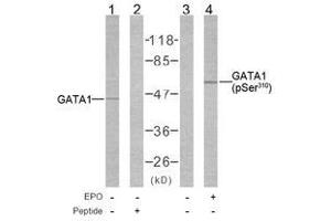 Image no. 1 for anti-GATA Binding Protein 1 (Globin Transcription Factor 1) (GATA1) (pSer310) antibody (ABIN2621191) (GATA1 抗体  (pSer310))