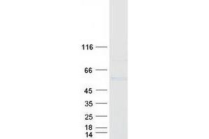 Validation with Western Blot (GAL3ST4 Protein (Myc-DYKDDDDK Tag))
