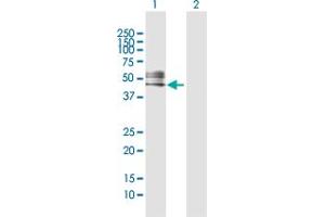 Western Blot analysis of RTN4R expression in transfected 293T cell line by RTN4R MaxPab polyclonal antibody. (RTN4R 抗体  (AA 1-473))
