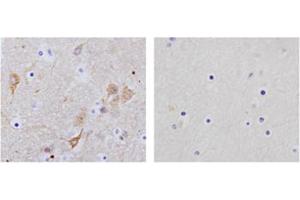 Immunohistochemistry analysis of human brain tissue slide (Paraffin embedded) using Rabbit Anti-NSE Polyclonal Antibody (Left, ABIN398881) and Purified Rabbit IgG (Whole molecule) Control (Right, ABIN398653) (ENO2/NSE 抗体  (C-Term))