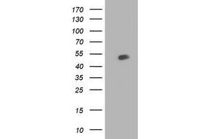 HEK293T cells were transfected with the pCMV6-ENTRY control (Left lane) or pCMV6-ENTRY BECN1 (Right lane) cDNA for 48 hrs and lysed. (Beclin 1 抗体)