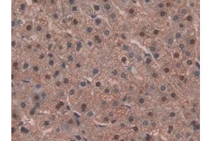 Immunohistochemistry (IHC) image for anti-Isocitrate Dehydrogenase 1 (NADP+), Soluble (IDH1) (AA 74-333) antibody (ABIN7436579)