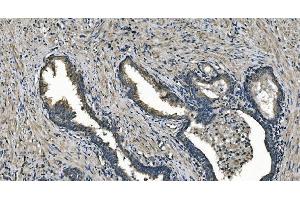 IHC analysis of DNAJC10 using anti-DNAJC10 antibody (ABIN7601358).