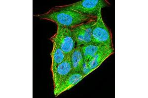 Immunofluorescence (IF) image for anti-Homeobox A9 (HOXA9) (AA 1-272) antibody (ABIN5542330)