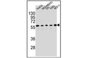 Western blot analysis of PAX1 Antibody (C-term) in HepG2, MDA-MB453, 293, K562, MCF-7 cell line lysates (35ug/lane). (PAX1 抗体  (C-Term))