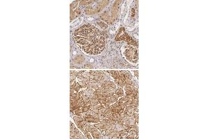 Immunohistochemical staining of human heart muscle with LAMB2 polyclonal antibody  shows distinct membranous positivity in myocytes. (LAMB2 抗体)