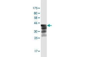 Western Blot detection against Immunogen (44. (HSPB7 抗体  (AA 1-170))