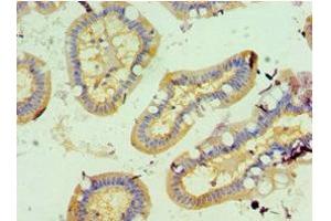 Immunohistochemistry of paraffin-embedded human small intestine tissue using ABIN7153890 at dilution of 1:100 (GCK 抗体  (AA 1-300))