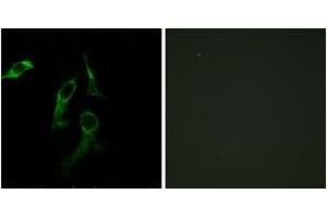 Immunofluorescence analysis of HepG2/HeLa cells, using HARS Antibody. (HARS1/Jo-1 抗体  (AA 460-509))