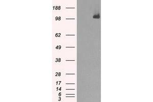 Image no. 5 for anti-Budding Uninhibited By Benzimidazoles 1 Homolog beta (Yeast) (BUB1B) antibody (ABIN1496995) (BUB1B 抗体)