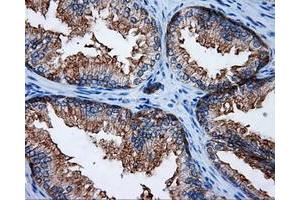 Immunohistochemical staining of paraffin-embedded Kidney tissue using anti-RALBP1 mouse monoclonal antibody. (RALBP1 抗体)