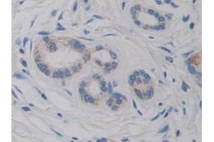 Immunohistochemistry (IHC) image for anti-Cytochrome P450, Family 21, Subfamily A, Polypeptide 2 (CYP21A2) (AA 106-389) antibody (ABIN7441886)