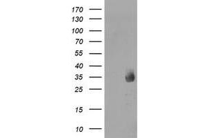 Western Blotting (WB) image for anti-Methylmalonic Aciduria (Cobalamin Deficiency) CblC Type, with Homocystinuria (MMACHC) antibody (ABIN1499512) (MMACHC 抗体)