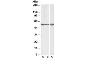 Western blot testing of human [A] and mouse [B] liver, and rat [C] testis lysate with ALDH1A1 antibody at 0. (ALDH1A1 抗体)