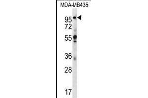 CTAGE5 Antibody (C-term) (ABIN656676 and ABIN2845915) western blot analysis in MDA-M cell line lysates (35 μg/lane). (MIA2 抗体  (C-Term))