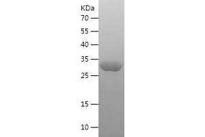 Western Blotting (WB) image for S100 Calcium Binding Protein A12 (S100A12) (AA 2-92) protein (His-IF2DI Tag) (ABIN7124950)