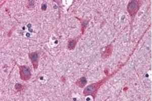 Immunohistochemistry (IHC) image for anti-Signal Transducing Adaptor Family Member 2 (STAP2) (C-Term) antibody (ABIN184610)