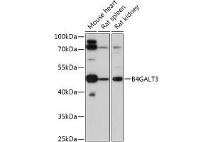 Western blot analysis of extracts of various cell lines, using B4G antibody (ABIN7271199) at 1:1000 dilution. (B4GALT3 抗体  (AA 40-150))